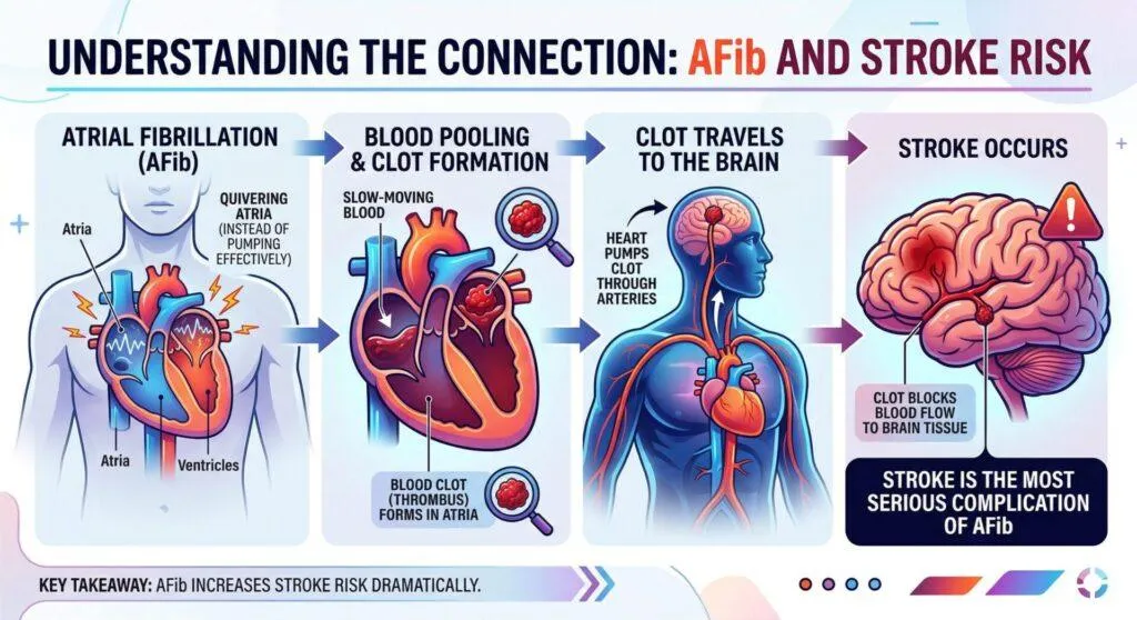 The Stroke Risk
